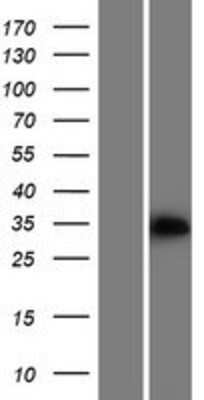 Western Blot: PPA2 Overexpression Lysate (Adult Normal) [NBP2-05020] Left-Empty vector transfected control cell lysate (HEK293 cell lysate); Right -Over-expression Lysate for PPA2.