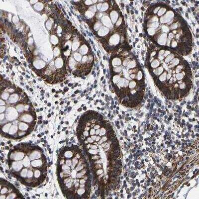 Immunohistochemistry: P2Y11/P2RY11 Antibody [NBP1-87465] - Staining of human rectum shows strong granular cytoplasmic positivity in glandular cells.