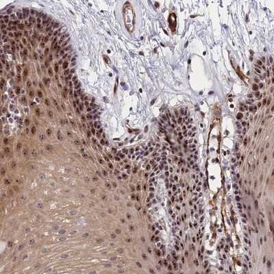 Immunohistochemistry-Paraffin: PPAN Antibody [NBP1-88525] - Staining of human oral mucosa shows strong nucleolar positivity in squamous epithelial cells.