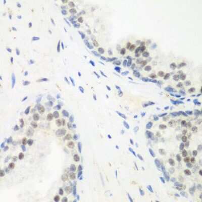 Immunohistochemistry-Paraffin PPAN Antibody - BSA Free