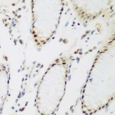 Immunohistochemistry-Paraffin: PPAN Antibody [NBP2-93075] - Paraffin-embedded human stomach using PPAN .