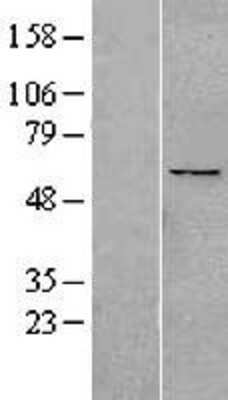 Western Blot: PPAN Overexpression Lysate (Adult Normal) [NBL1-14624] Left-Empty vector transfected control cell lysate (HEK293 cell lysate); Right -Over-expression Lysate for PPAN.