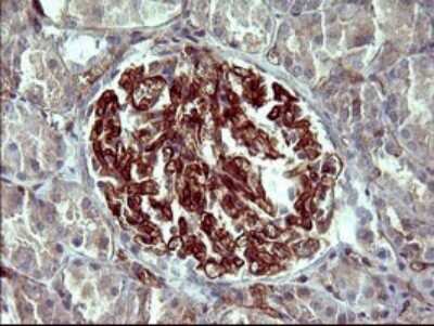 Immunohistochemistry PPAP2A Antibody (OTI1H4)