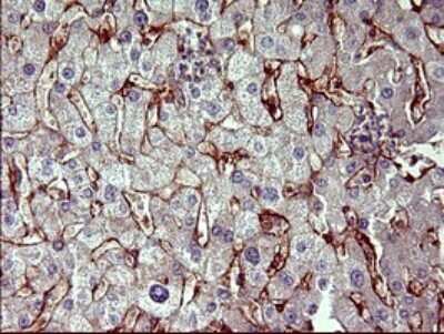 Immunohistochemistry PPAP2A Antibody (OTI1H4)