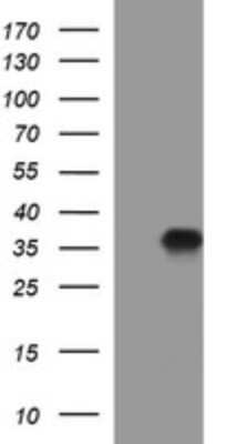 Western Blot: PPAP2A Antibody (1H4) [NBP2-45378] - Analysis of HEK293T cells were transfected with the pCMV6-ENTRY control (Left lane) or pCMV6-ENTRY PPAP2A.