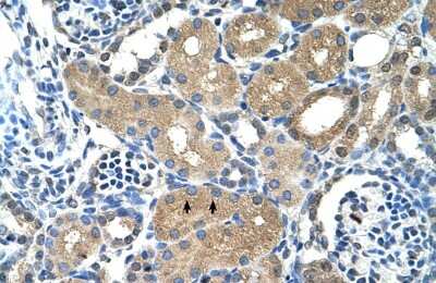 Immunohistochemistry-Paraffin: PPAP2A Antibody [NBP1-59011] - Human kidney Tissue, antibody concentration 4-8ug/ml. Cells with positive label: renal corpuscle cells (indicated with arrows) 400X magnification.