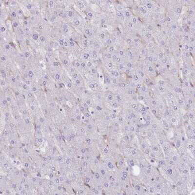 Immunohistochemistry-Paraffin: PPAP2A Antibody [NBP2-32057] - Staining of human liver shows low expression as expected.