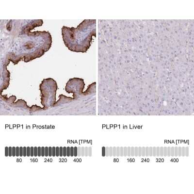 <b>Orthogonal Strategies Validation. </b>Immunohistochemistry-Paraffin: PPAP2A Antibody [NBP2-32057] - Staining in human prostate and liver tissues using anti-PLPP1 antibody. Corresponding PLPP1 RNA-seq data are presented for the same tissues.