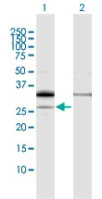 Western Blot: PPAP2A Antibody [H00008611-D01P] - Analysis of PPAP2A expression in transfected 293T cell line by PPAP2A polyclonal antibody.Lane 1: PPAP2A transfected lysate(32.20 KDa).Lane 2: Non-transfected lysate.