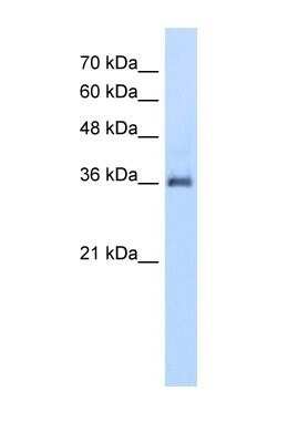 Western Blot: PPAP2A Antibody [NBP1-59011] - HepG2 cell lysate, Antibody Titration: 5.0ug/ml