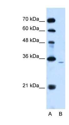 Western Blot: PPAP2A Antibody [NBP1-59025] - Jurkat cell lysate, Antibody Titration: 2.5ug/ml