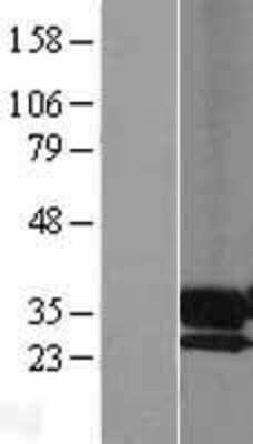 Western Blot: PPAP2A Overexpression Lysate (Adult Normal) [NBL1-14625] Left-Empty vector transfected control cell lysate (HEK293 cell lysate); Right -Over-expression Lysate for PPAP2A.