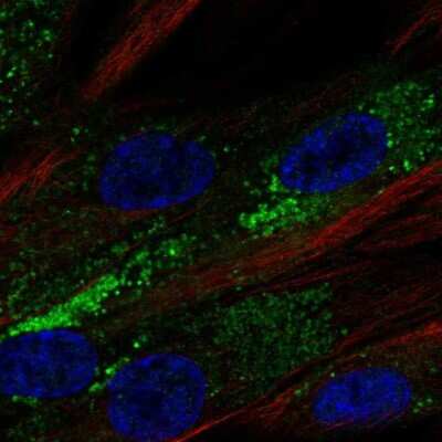 Immunocytochemistry/ Immunofluorescence PPAP2B Antibody