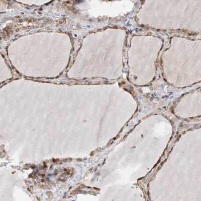 Immunohistochemistry-Paraffin: PPAP2B Antibody [NBP1-82825] - Staining of human thyroid gland shows moderate cytoplasmic and nuclear positivity in glandular cells.