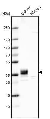 Western Blot PPAP2B Antibody