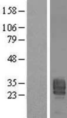 Western Blot: PPAP2B Overexpression Lysate (Adult Normal) [NBP2-05033] Left-Empty vector transfected control cell lysate (HEK293 cell lysate); Right -Over-expression Lysate for PPAP2B.