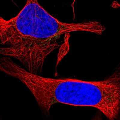 Immunocytochemistry/ Immunofluorescence PPAP2C Antibody