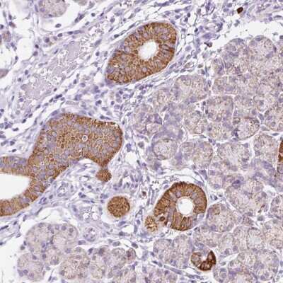 Immunohistochemistry-Paraffin PPAP2C Antibody