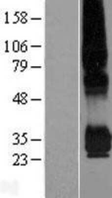 Western Blot: PPAP2C Overexpression Lysate (Adult Normal) [NBP2-07964] Left-Empty vector transfected control cell lysate (HEK293 cell lysate); Right -Over-expression Lysate for PPAP2C.