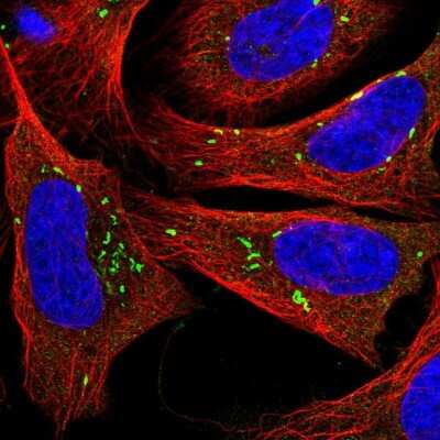 Immunocytochemistry/Immunofluorescence: PPAPDC1B/DPPL1 Antibody [NBP2-55527] - Staining of human cell line U-2 OS shows localization to vesicles.