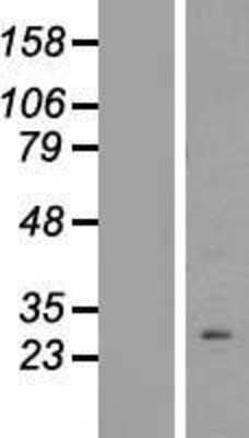 Western Blot: PPAPDC1B/DPPL1 Overexpression Lysate (Adult Normal) [NBL1-14628] Left-Empty vector transfected control cell lysate (HEK293 cell lysate); Right -Over-expression Lysate for PPAPDC1B/DPPL1.