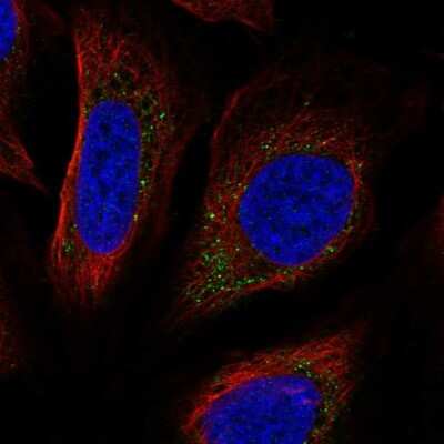 Immunocytochemistry/Immunofluorescence: PPAPDC3 Antibody [NBP2-56028] - Staining of human cell line U-2 OS shows localization to vesicles.