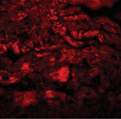 Immunofluorescence: PPAPDC3 Antibody [NBP1-72140] - Immunofluorescence of PPAPDC3 in mouse heart tissue with PPAPDC3 antibody at 20 ug/ml.