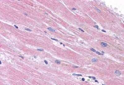 Immunohistochemistry-Paraffin: PPAPDC3 Antibody [NBP1-72140] - Analysis of anti-PPAPDC3 antibody with human heart at concentration 5 ug/ml.