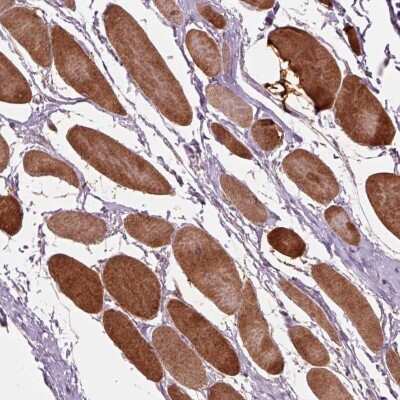 Immunohistochemistry-Paraffin: PPAPDC3 Antibody [NBP2-56028] - Immunohistochemical staining of human skeletal muscle shows strong cytoplasmic positivity in myocytes.