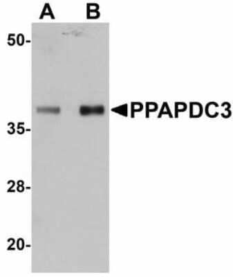 Western Blot: PPAPDC3 Antibody [NBP1-72140] - Western blot of PPAPDC3 in mouse heart tissue lysate with PPAPDC3 antibody at (A) 1 and (B) 2 ug/ml.