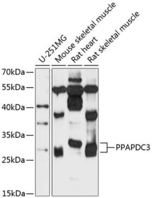 Western Blot: PPAPDC3 Antibody [NBP3-04774] - Analysis of extracts of various cell lines, using PPAPDC3 antibody at 1:3000 dilution. Secondary antibody: HRP Goat Anti-Rabbit IgG (H+L) at 1:10000 dilution. Lysates/proteins: 25ug per lane. Blocking buffer: 3% nonfat dry milk in TBST. Detection: ECL Enhanced Kit.