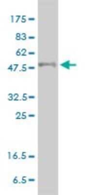 Western Blot: PPAR delta/NR1C2 Antibody (4E3-1B11) [H00005467-M01] - PPARD monoclonal antibody (M01), clone 4E3-1B11 Analysis of PPARD expression in Jurkat.