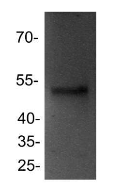 Western Blot: PPAR delta/NR1C2 Antibody [NB300-962] - PPAR delta in HeLa cell lysate (25 ug) using anti-PPAR delta antibody. Image from verified customer review.