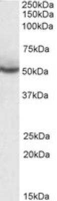 Western Blot: PPAR delta/NR1C2 Antibody [NB300-962] - Staining of MOLT4 lysate (35 ug protein in RIPA buffer). Antibody at 0.3 ug/mL. Detected by chemiluminescence.