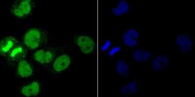 Immunocytochemistry/Immunofluorescence: PPAR gamma/NR1C3 Antibody [NBP2-76958] - ICC staining PPAR gamma in A431 cells (green). The nuclear counter stain is DAPI (blue). Cells were fixed in paraformaldehyde, permeabilised with 0.25% Triton X100/PBS.