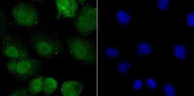 Immunocytochemistry/Immunofluorescence: PPAR gamma/NR1C3 Antibody [NBP2-76958] - ICC staining PPAR gamma in A549 cells (green). The nuclear counter stain is DAPI (blue). Cells were fixed in paraformaldehyde, permeabilised with 0.25% Triton X100/PBS.