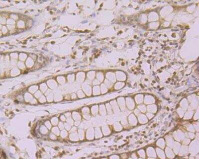 Immunohistochemistry: PPAR gamma/NR1C3 Antibody [NBP2-76958] - Immunohistochemical analysis of paraffin-embedded human colon tissue using anti-PPAR gamma antibody. Counter stained with hematoxylin.