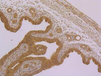 Immunohistochemistry: PPAR gamma/NR1C3 Antibody [NBP2-76958] - Immunohistochemical analysis of paraffin-embedded mouse uterus tissue using anti-PPAR gamma antibody. Counter stained with hematoxylin.