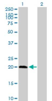 Western Blot: PPCDC Antibody [H00060490-B01P] - Analysis of PPCDC expression in transfected 293T cell line by PPCDC polyclonal antibody.  Lane 1: PPCDC transfected lysate(22.44 KDa). Lane 2: Non-transfected lysate.