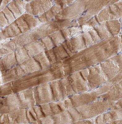 Immunohistochemistry-Paraffin: PPDPFL Antibody [NBP2-31818] - Staining of human skeletal muscle shows strong cytoplasmic positivity in myocytes.