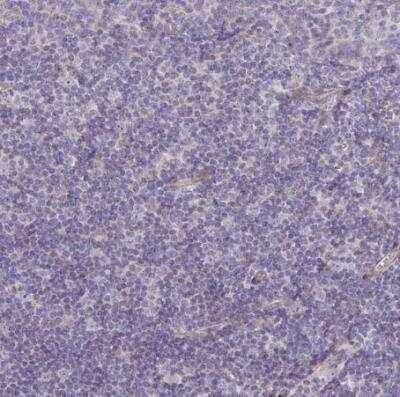 Immunohistochemistry-Paraffin: PPDPFL Antibody [NBP2-31818] - Staining of human tonsil shows no positivity in non-germinal center cells as expected.