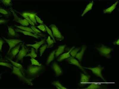 Immunocytochemistry/Immunofluorescence: PPEF1 Antibody [H00005475-D01P] - Analysis of antibody to PPEF1 on HeLa cell. Antibody concentration 30 ug/ml.