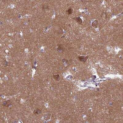 Immunohistochemistry: PPFIA3 Antibody [NBP2-30453] - Immunohistochemical staining of human lateral ventricle shows moderate cytoplasmic positivity in neuronal cells.