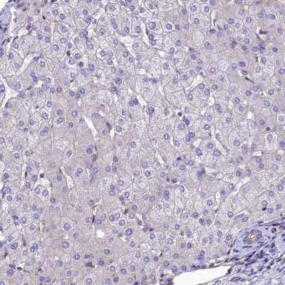 Immunohistochemistry-Paraffin PPFIA3 Antibody - BSA Free