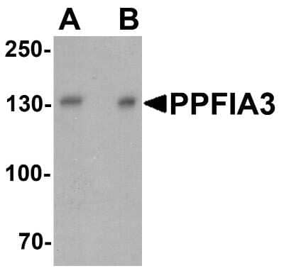 Western Blot: PPFIA3 Antibody [NBP2-81985] - Western blot analysis of PPFIA3 in 293 cell lysate with PPFIA3 antibody at (A) 1 and (B) 2 ug/ml.