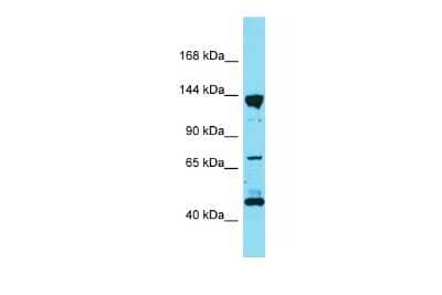 Western Blot: PPFIA3 Antibody [NBP2-85513] - Host: Rabbit. Target Name: Ppfia3. Sample Type: Rat Lung lysates. Antibody Dilution: 1.0ug/ml