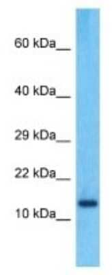Western Blot: PPIAL4C Antibody [NBP3-09879] - Western blot analysis of PPIAL4C in A549 Whole Cell lysates. Antibody dilution at 1.0ug/ml