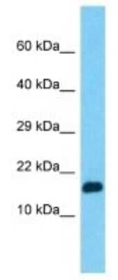 Western Blot: PPIAL4G Antibody [NBP3-09878] - Western blot analysis of PPIAL4G in HepG2 Whole Cell lysates. Antibody dilution at 1.0ug/ml