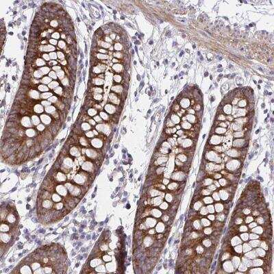 Immunohistochemistry-Paraffin: PPIH Antibody [NBP2-32416] - Staining of human colon shows strong cytoplasmic positivity in glandular cells.