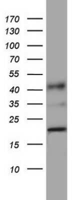 Western Blot: PPIH Antibody (OTI1C6) - Azide and BSA Free [NBP2-73572] - Analysis of A549 cell lysate (35ug).